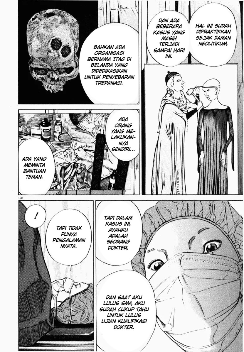 Homunculus Chapter 3 - Page 29